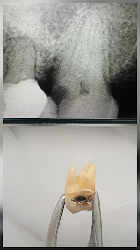 Pooja Smile Care Dental Gallery Image 15